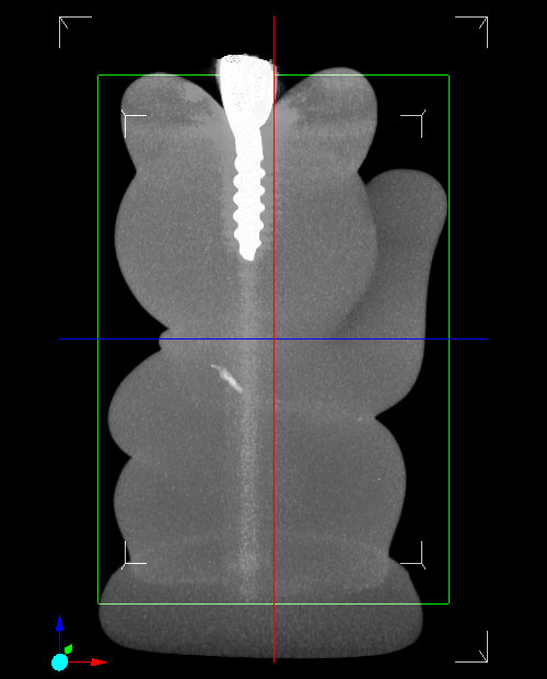 招き猫 X線CT画像 MIP クリップ/横回転