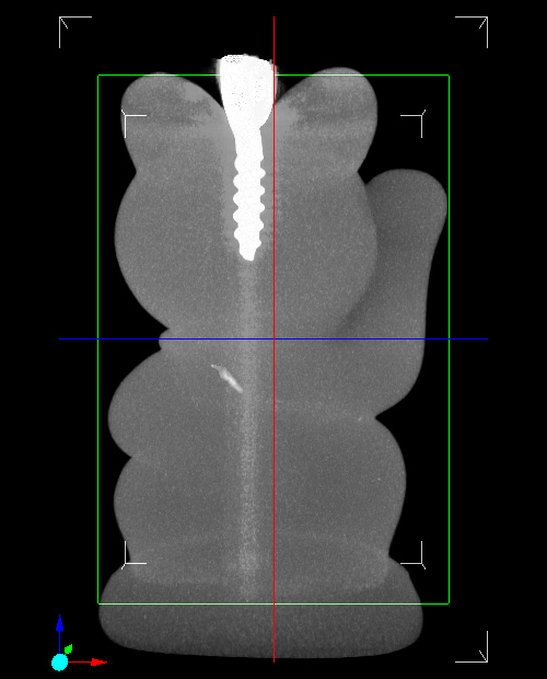 招き猫 X線CT画像 MIP スライス/横回転